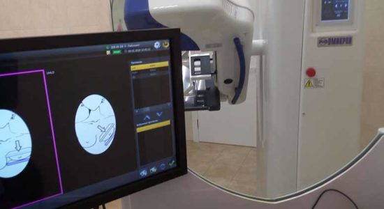 В жуковской поликлинике женщинам бесплатно проведут маммографию