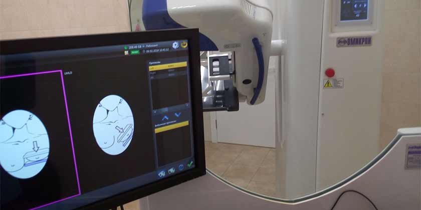 В жуковской поликлинике женщинам бесплатно проведут маммографию